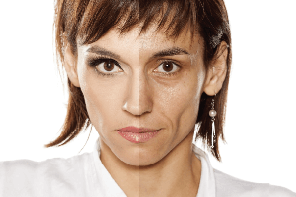 WHAT HAPPENS TO YOUR SKIN WHEN YOU QUIT SMOKING - SMOKO E Cigarettes