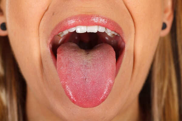 Was ist die Zunge des Dampfers und wie kann man sie heilen?
