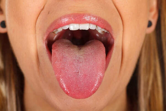 WHAT IS VAPER’S TONGUE AND HOW TO CURE IT?