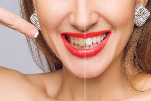 smoking cigarettes causes yellow teeth, gum disease and bad breath